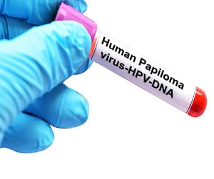 HPV-DNA Testing